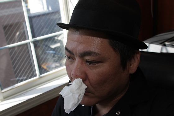 鼻血が垂れている様子を写した写真