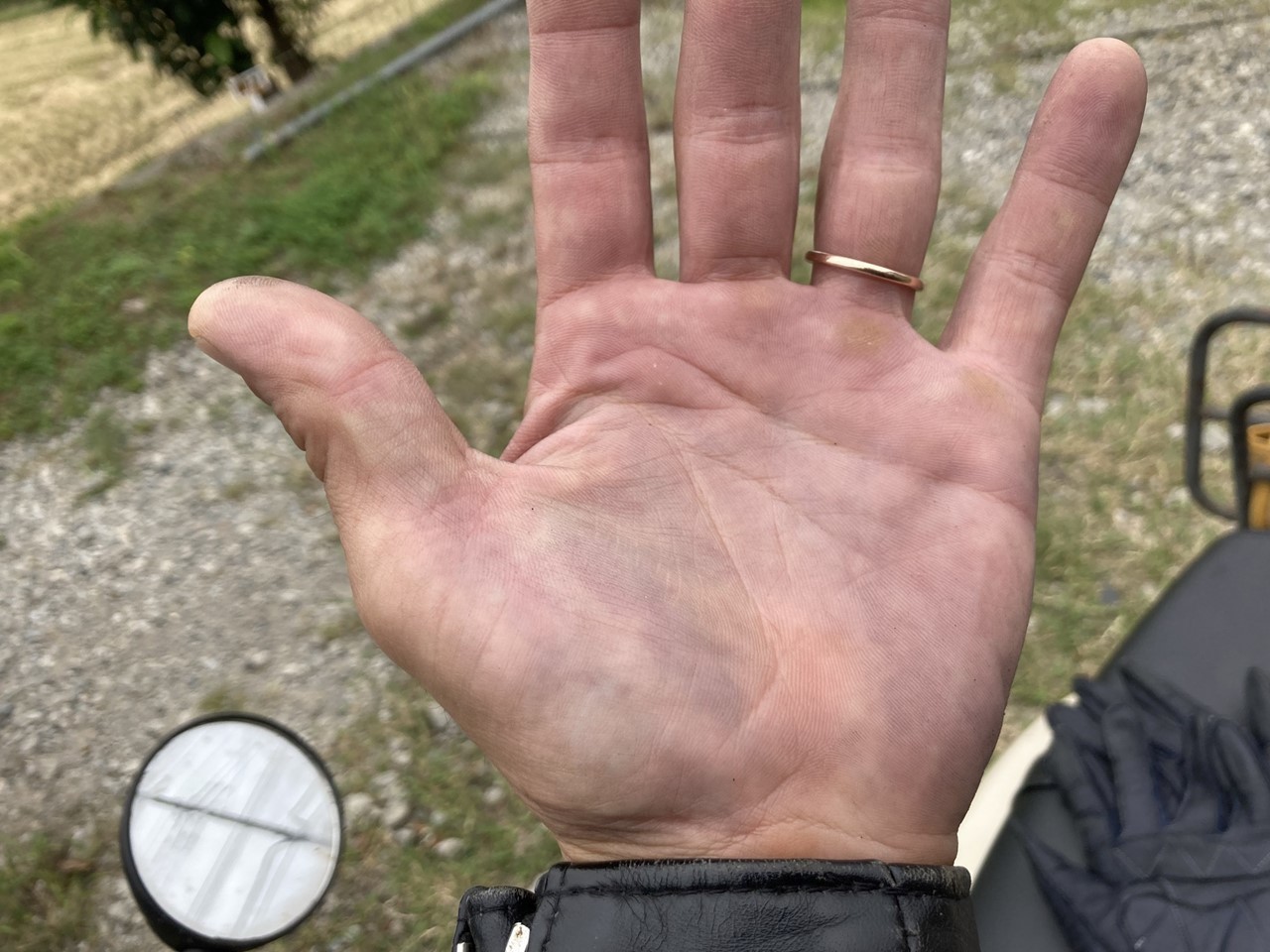 色落ちで手が真っ青になった様子
